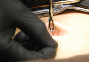 Navel piercing