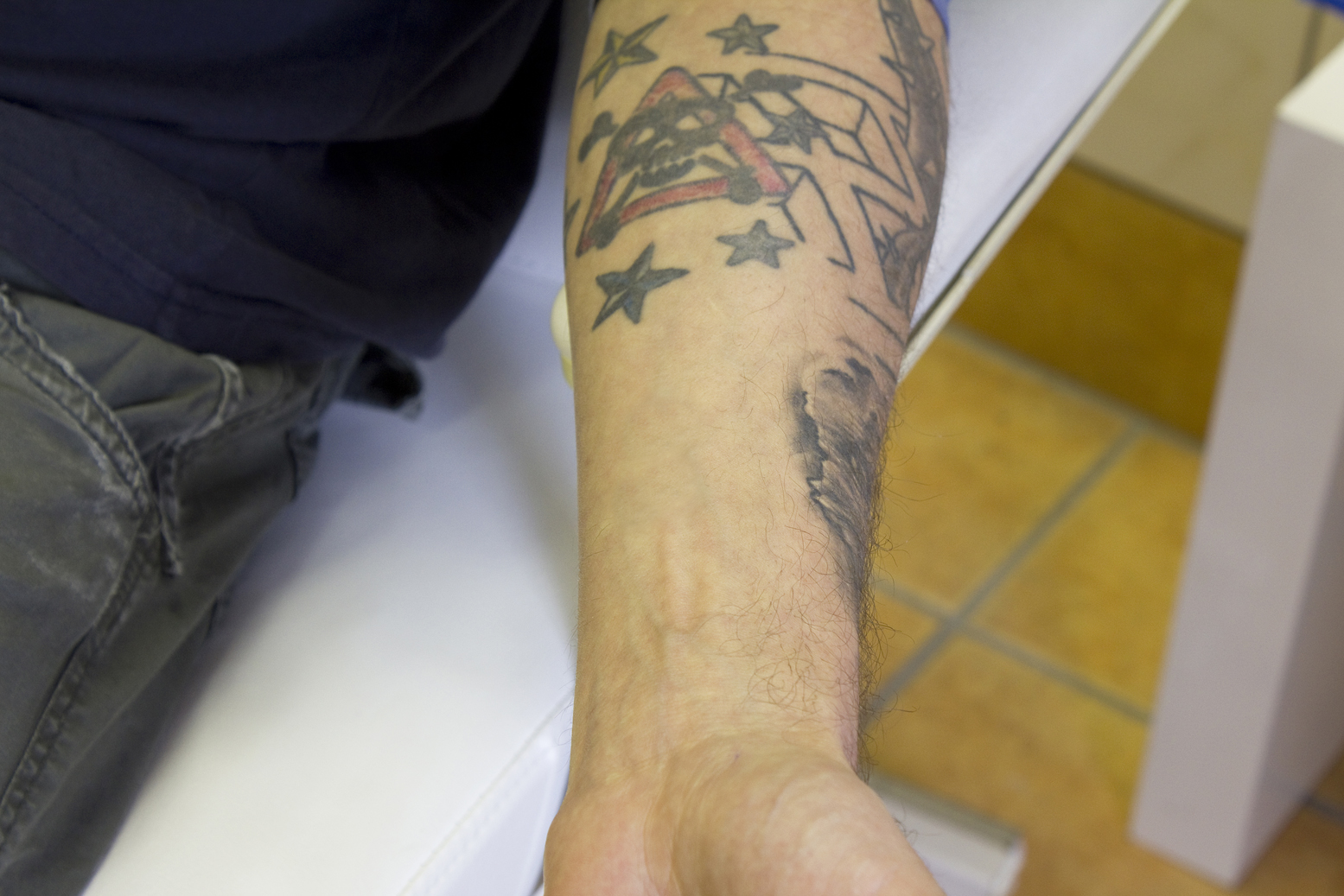Walter Cunningham Eekhoorn Identificeren Tattoo verwijderen Amsterdam - Amsterdam tattooing